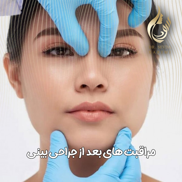 راهنما مراقبت های بعد از جراحی بینی - دکتر سودا کریمی