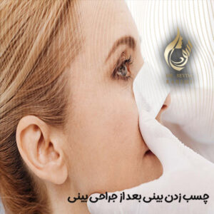 چسب زدن بینی بعد از جراحی بینی - دکتر سودا کریمی