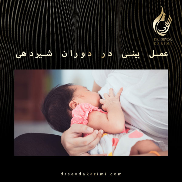 عمل بینی در دوران شیردهی drsevdakarimi.com