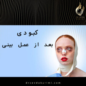 کبودی بعد از عمل بینی _ دکتر سودا کریمی