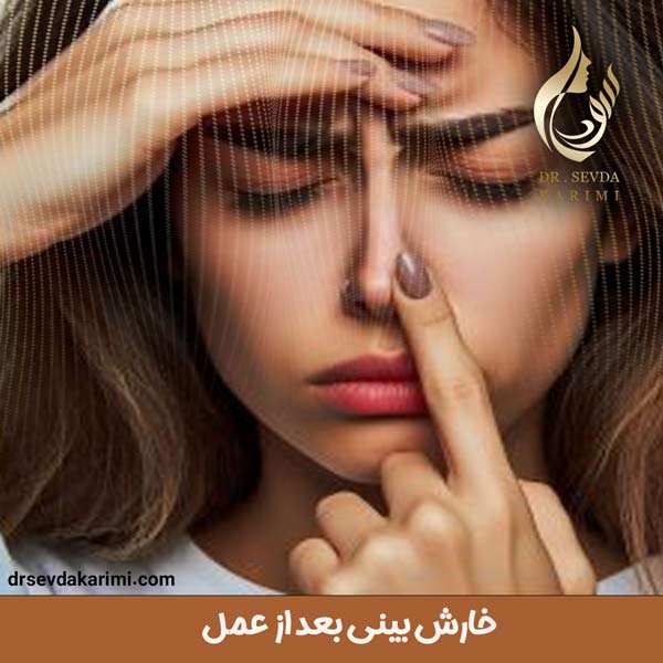 خارش بینی بعد از عمل