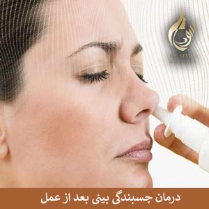 درمان چسبندگی بینی بعد از جراحی _ دکتر سودا کریمی