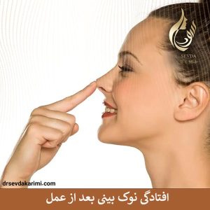 افتادگی نوک بینی بعد از جراحی _ دکتر سودا کریمی