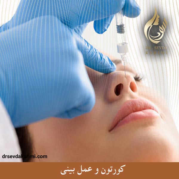کورتون و عمل بینی _ دکتر سودا کریمی