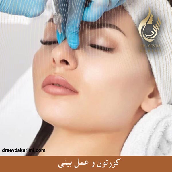 کورتون و عمل بینی _ دکتر سودا کریمی