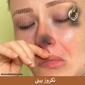 نکروز بینی بعد از عمل _ دکتر سودا کریمی