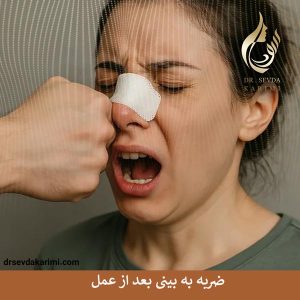 ضربه به بینی بعد از عمل _ دکتر سودا کریمی