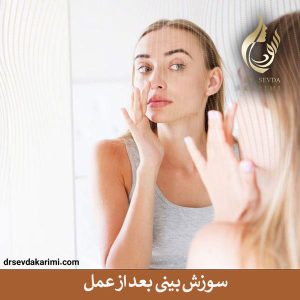 سوزش بینی بعد از عمل _ دکتر سودا کریمی