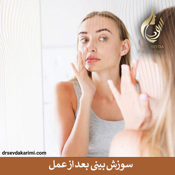 سوزش بینی بعد از عمل _ دکتر سودا کریمی